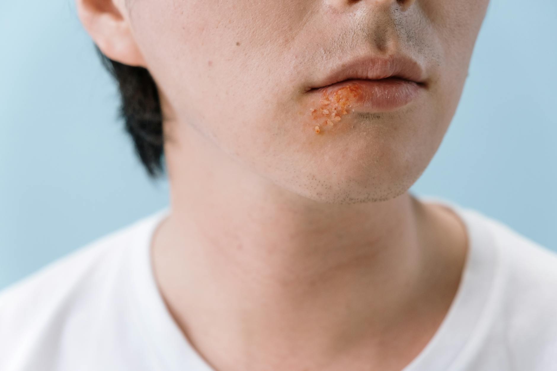Exploring Natural Cures for Common Skin Issues